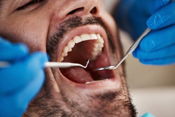 Best Urgent Tooth Repair  in Flower Hill, MD