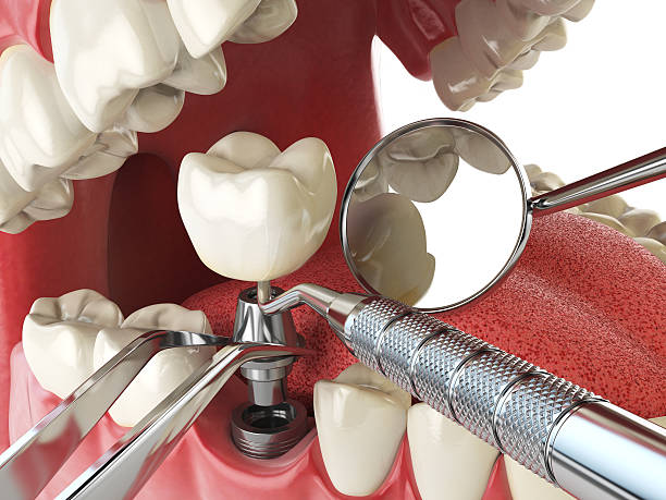 Best Root Canal Emergency Dentist  in Flower Hill, MD